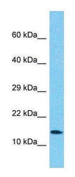 Anti-ATP5F1D antibody produced in rabbit affinity isolated antibody