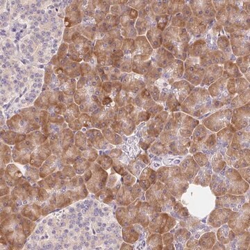 Anti-RPL18A antibody produced in rabbit Prestige Antibodies&#174; Powered by Atlas Antibodies, affinity isolated antibody, buffered aqueous glycerol solution