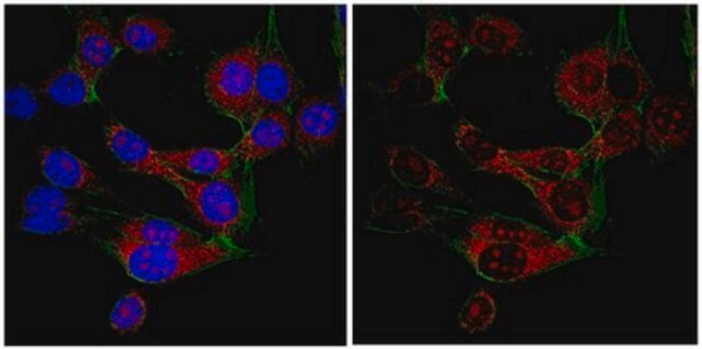 Anti-SRp30a (SF2) Antibody from rabbit