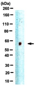 Anti-Jarid2 Antibody serum, from rabbit