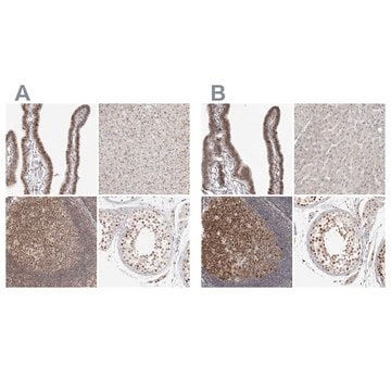 Anti-MSH6 antibody produced in rabbit Prestige Antibodies&#174; Powered by Atlas Antibodies, affinity isolated antibody, buffered aqueous glycerol solution, ab2