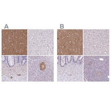 Anti-TPPP antibody produced in rabbit Prestige Antibodies&#174; Powered by Atlas Antibodies, affinity isolated antibody, buffered aqueous glycerol solution