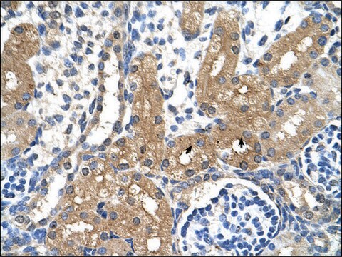 Anti-CYP4A22 antibody produced in rabbit affinity isolated antibody