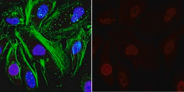 Anti-O-Linked N-Acetylglucosamine Antibody, clone RL2 clone RL2, from mouse