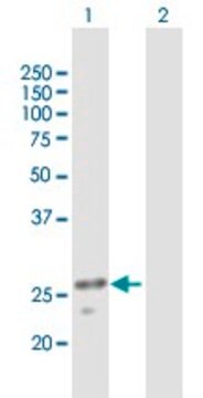 Anti-ULK3 antibody produced in mouse purified immunoglobulin, buffered aqueous solution