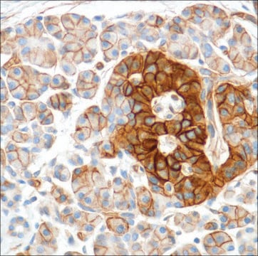 Anti-HENT1 antibody, Rabbit monoclonal clone SP120, recombinant, expressed in proprietary host, affinity isolated antibody