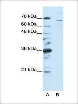 Anti-SF1 (AB1) antibody produced in rabbit affinity isolated antibody