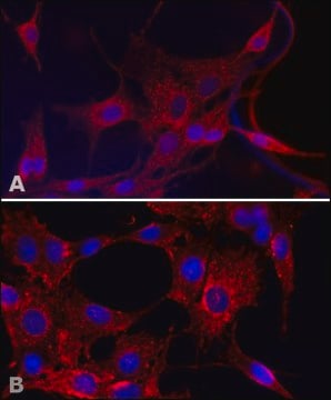 Anti-Superoxide Dismutase (MnSOD) (DD-17) antibody produced in rabbit affinity isolated antibody, buffered aqueous solution