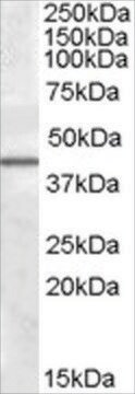 Anti-CAMK1D antibody produced in goat affinity isolated antibody, buffered aqueous solution