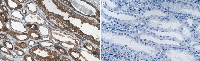 Anti-CH25H Antibody, clone 1G14 ZooMAb&#174; Rabbit Monoclonal recombinant, expressed in HEK 293 cells