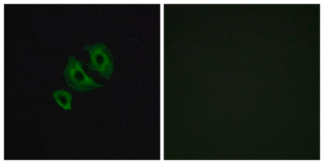 Anti-OR10J6 antibody produced in rabbit affinity isolated antibody