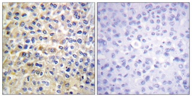 Anti-EGFR antibody produced in rabbit affinity isolated antibody