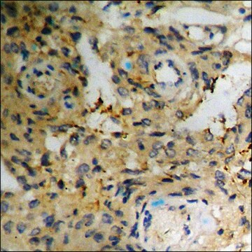 Anti-phospho-Telomerase (pSer824) antibody produced in rabbit affinity isolated antibody