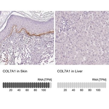 Anti-COL7A1 antibody produced in rabbit Prestige Antibodies&#174; Powered by Atlas Antibodies, affinity isolated antibody, buffered aqueous glycerol solution