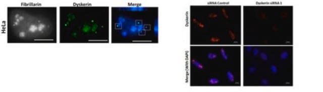 Anti-Dyskerin (Rabbit) from rabbit, purified by affinity chromatography