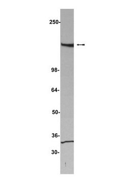 Anti-HET/SAF-B Antibody, clone 6F7 clone 6F7, Upstate&#174;, from mouse