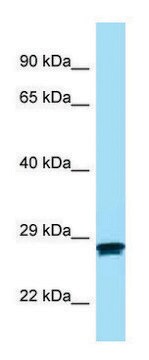 Anti-MC2R (N-terminal) antibody produced in rabbit affinity isolated antibody