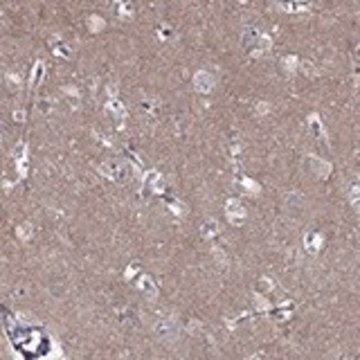 Anti-LY6H antibody produced in rabbit Prestige Antibodies&#174; Powered by Atlas Antibodies, affinity isolated antibody, buffered aqueous glycerol solution