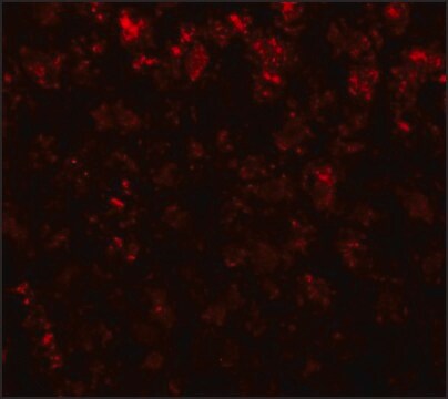 Anti-AFP antibody produced in rabbit affinity isolated antibody, buffered aqueous solution