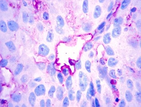 Anti-LYVE1 Antibody from rabbit, purified by affinity chromatography