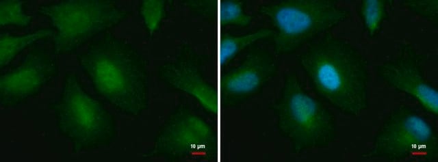 Monoclonal Anti-O-GlcNAc transferase antibody produced in mouse clone GT678, affinity isolated antibody