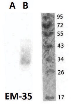 Monoclonal Anti-FOLR2 antibody produced in mouse clone EM-35