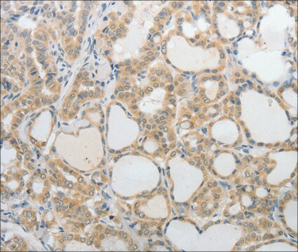 Anti-UCN antibody produced in rabbit affinity isolated antibody