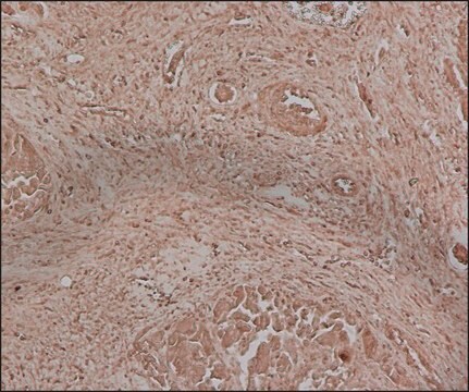 Anti-Fetuin A antibody, Mouse monoclonal clone FetA-M, purified from hybridoma cell culture