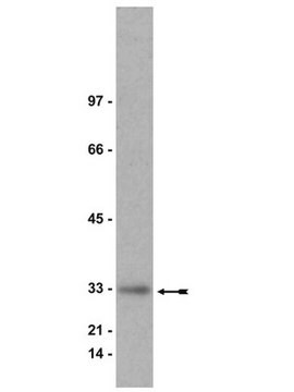 Anti-Kip1 (p27) Antibody Upstate&#174;, from rabbit