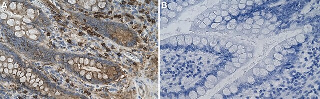 Anti-&#945;-Actinin-1 Antibody, clone 2C17 ZooMAb&#174; Rabbit Monoclonal recombinant, expressed in HEK 293 cells