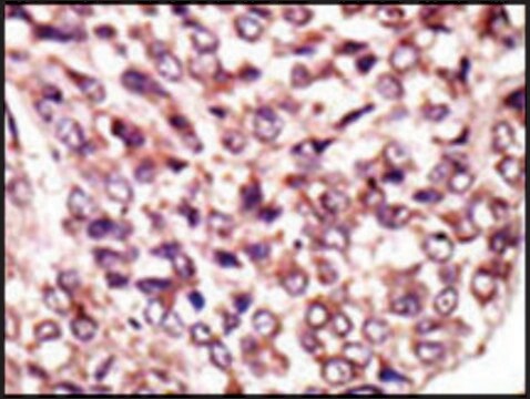 Anti-MGAT1 (N-term) antibody produced in rabbit IgG fraction of antiserum, buffered aqueous solution