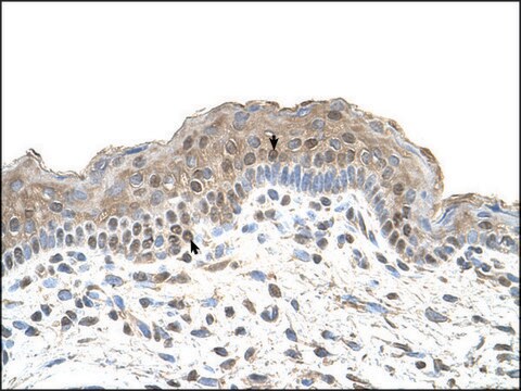 Anti-TAPBP antibody produced in rabbit affinity isolated antibody