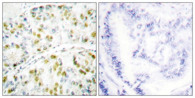 Anti-Ataxin 1, C-Terminal antibody produced in rabbit affinity isolated antibody