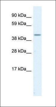 Anti-SerPINH1 antibody produced in rabbit IgG fraction of antiserum