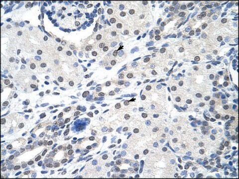 Anti-SNRPA antibody produced in rabbit affinity isolated antibody