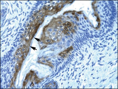 Anti-HDAC2 antibody produced in rabbit affinity isolated antibody