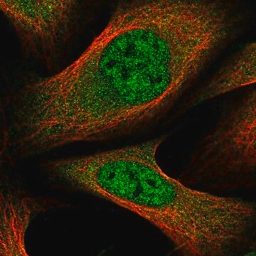 Anti-GLMN antibody produced in rabbit Prestige Antibodies&#174; Powered by Atlas Antibodies, affinity isolated antibody, buffered aqueous glycerol solution