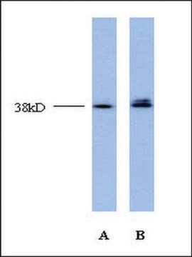 Anti-TCF4 (AB2) antibody produced in rabbit affinity isolated antibody