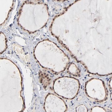 Anti-MSL2 antibody produced in rabbit Prestige Antibodies&#174; Powered by Atlas Antibodies, affinity isolated antibody, buffered aqueous glycerol solution