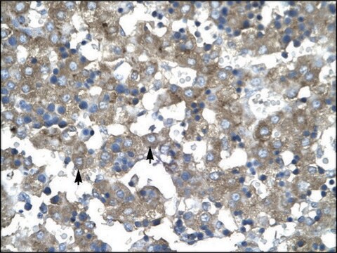 Anti-KLF15 antibody produced in rabbit IgG fraction of antiserum