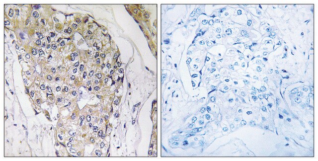 Anti-NDUFS6 antibody produced in rabbit affinity isolated antibody