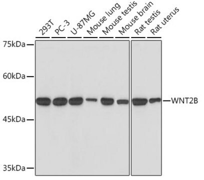 Anti-WNT2B Antibody, clone 9M6O7, Rabbit Monoclonal