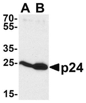 Anti-HIV-1 p24 antibody produced in rabbit affinity isolated antibody