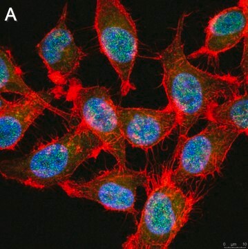 Anti-TCF-4 Antibody, clone 1G4 ZooMAb&#174; Rabbit Monoclonal recombinant, expressed in HEK 293 cells