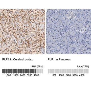 Anti-PLP1 antibody produced in rabbit Prestige Antibodies&#174; Powered by Atlas Antibodies, affinity isolated antibody, buffered aqueous glycerol solution