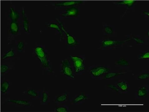 Monoclonal Anti-SOD1 antibody produced in mouse clone 10D5, purified immunoglobulin, buffered aqueous solution