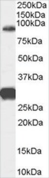 Anti-FOXP2 (Internal) antibody produced in goat affinity isolated antibody, buffered aqueous solution