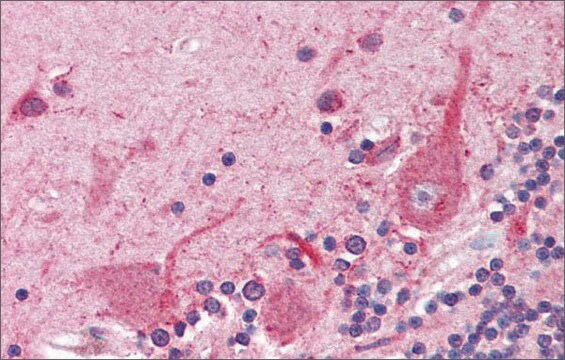 Anti-ATF4 affinity isolated antibody