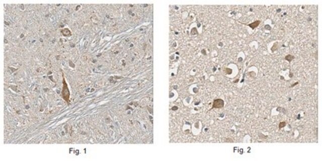 Anti-Choline Transporter Antibody from rabbit, purified by affinity chromatography