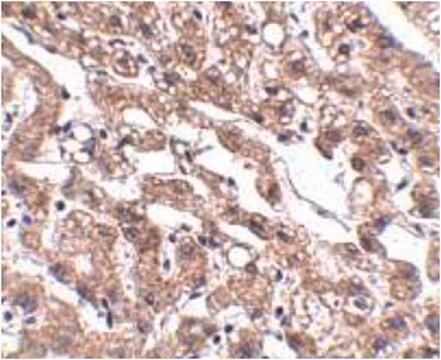 Anti-MACC1 Antibody from rabbit, purified by affinity chromatography